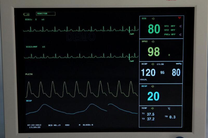 Multi-Parameter Vital Signs Patient Monitor - Image 3