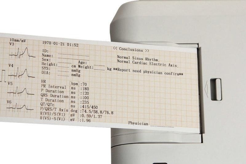 ECG / EKG Machine 3 Channels With Printer and Paper and USB Software ECG300G + USB+ PC Software - Image 4