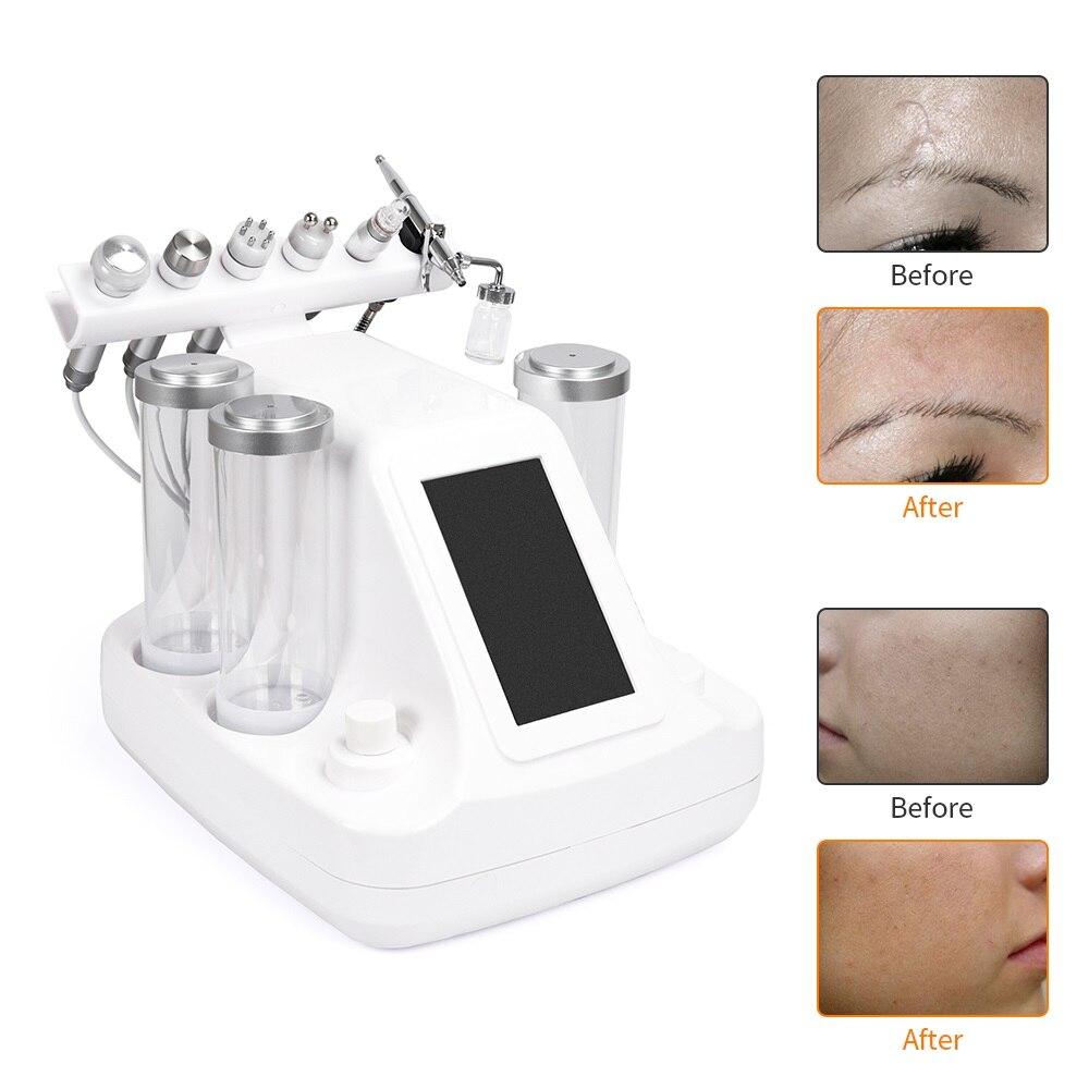 6 In 1 Small Bubbles Ultrasonic RF Hydra Deep Facial Ance Pore Cleaner Facial Massage Machine BIO Light Skin Care Device