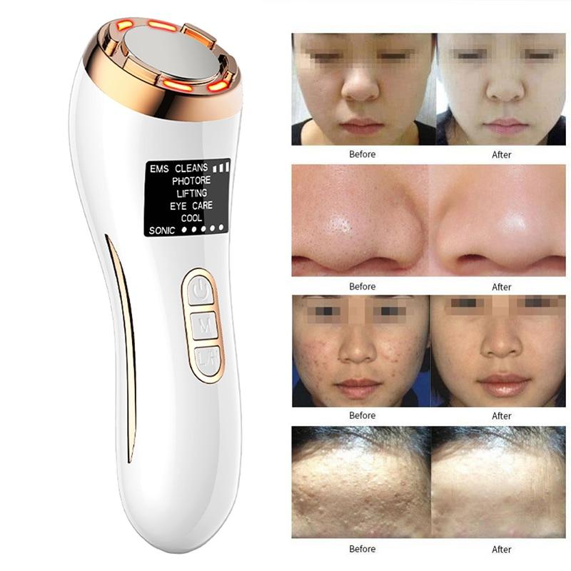 7in1Face Beauty EMS Mesotherapy Electroporation RF Radio Frequency LED Photon Skin Tightening Rejuvenation Facial Massager Lift