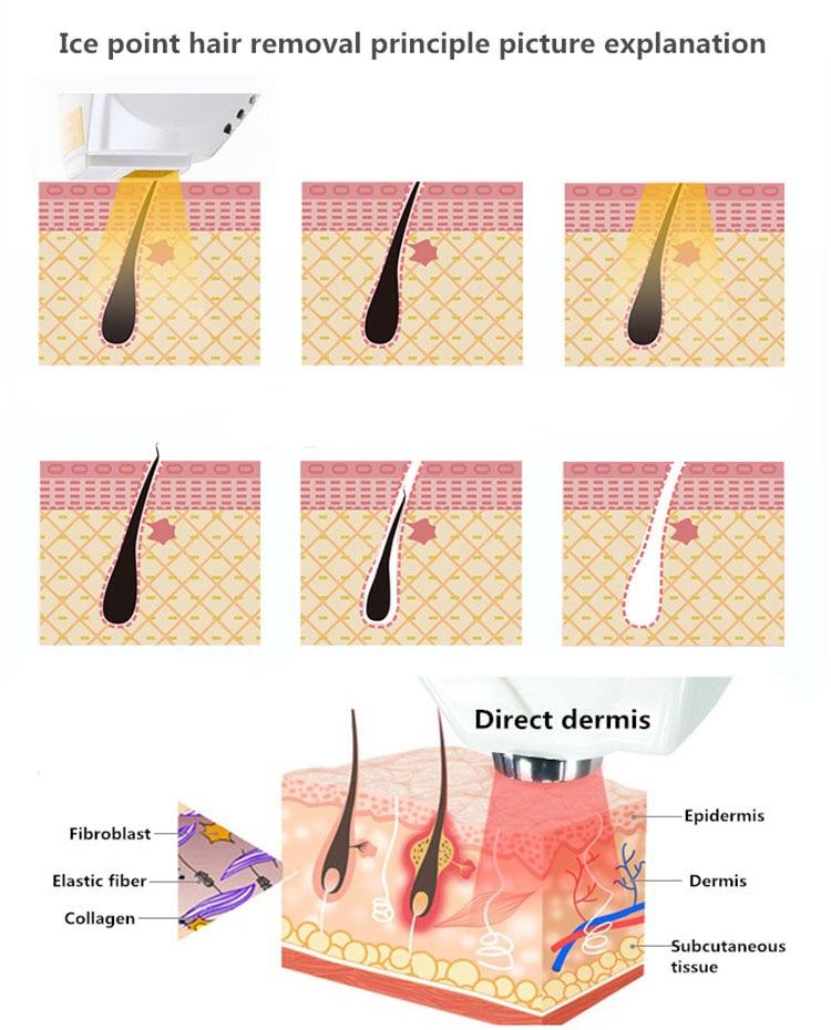 2021 Professional High Power Diode Laser 808nm Laser Hair Removal Machine 50 Million Shots Fast And Painless Cooling