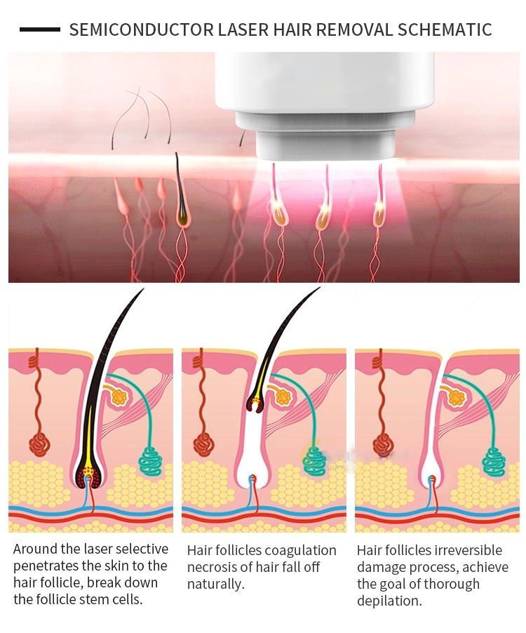 2021 Professional High Power Diode Laser 808nm Laser Hair Removal Machine 50 Million Shots Fast And Painless Cooling