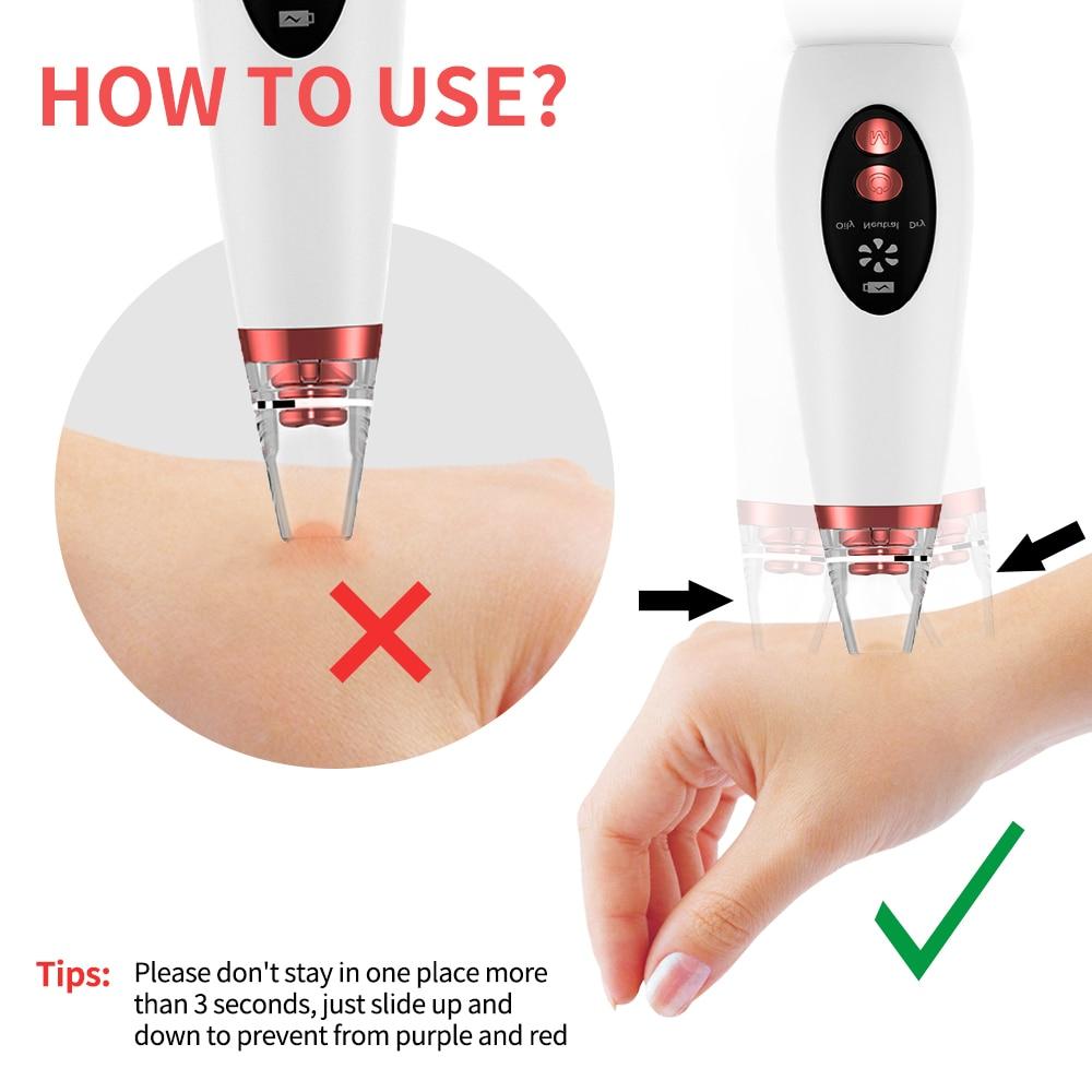 EMS RF Radio Frequency Blackhead Remover Skin Scrubber Face Cleaning Infrared Body Slimming Massager Lipo Facial Beauty Machine