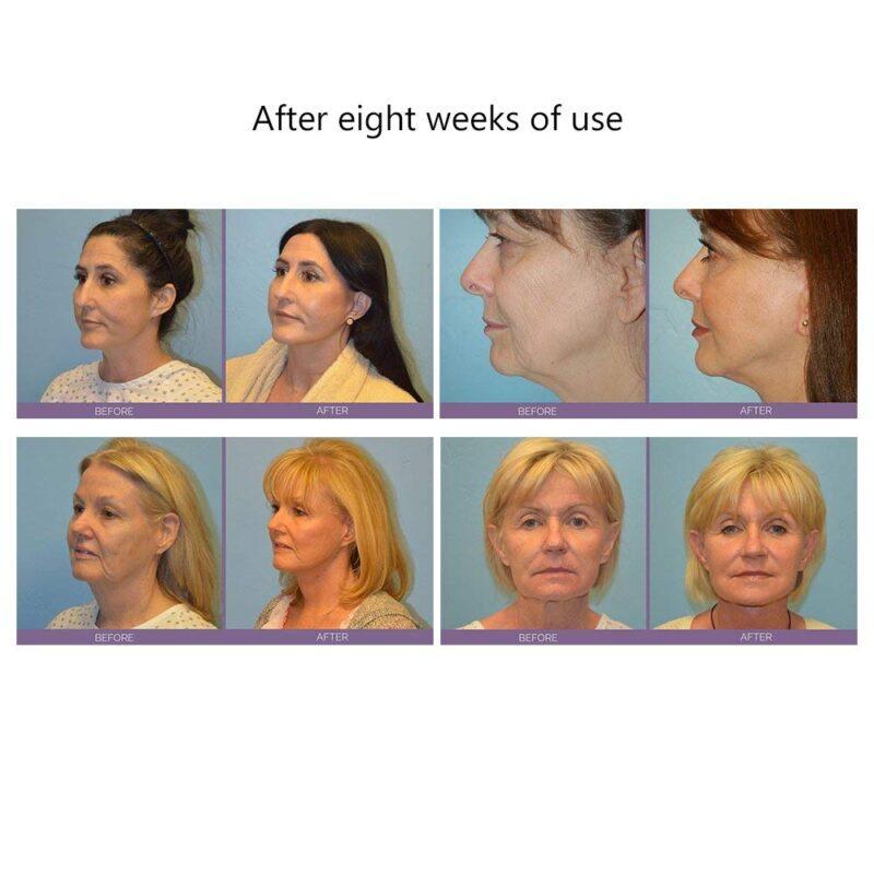 Face Massager For Facial Lifting Microcurrent Roller Massager Facial Microcurrent Device Massage Face Lift Machine - Image 4