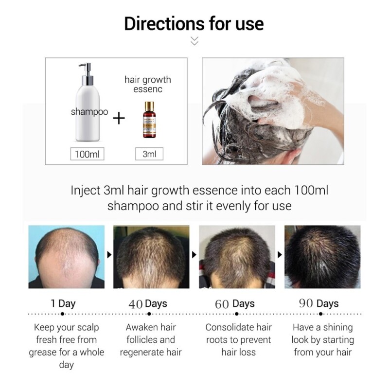 Hair Growth Essential Oils Essence Original Authentic 100% Hair Loss Liquid Health Care Beauty Dense Hair Growth Serum - Image 5