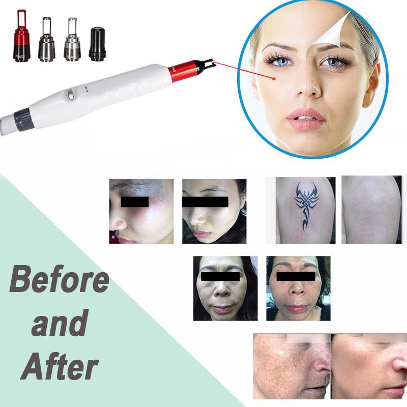 High Quality Nd Yag Laser 755 1320 1064 532nm Picosecond Laser Tattoo Removal Machine Face Skin Care Tools