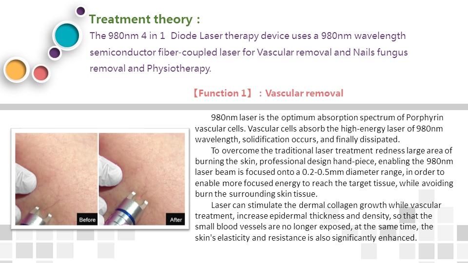 BEST 30W 4 in 1 980nm Diode Laser Vessel Removal Machine to remove spider veins 980 Vessels to remove nail fungus