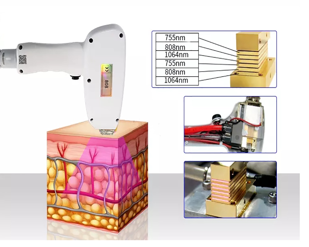 Diode Laser 755 808 1064nm Multi Wavelengths Hair Removal Machine Cooling Head Painless Laser Epilator Face Body Hair Removal