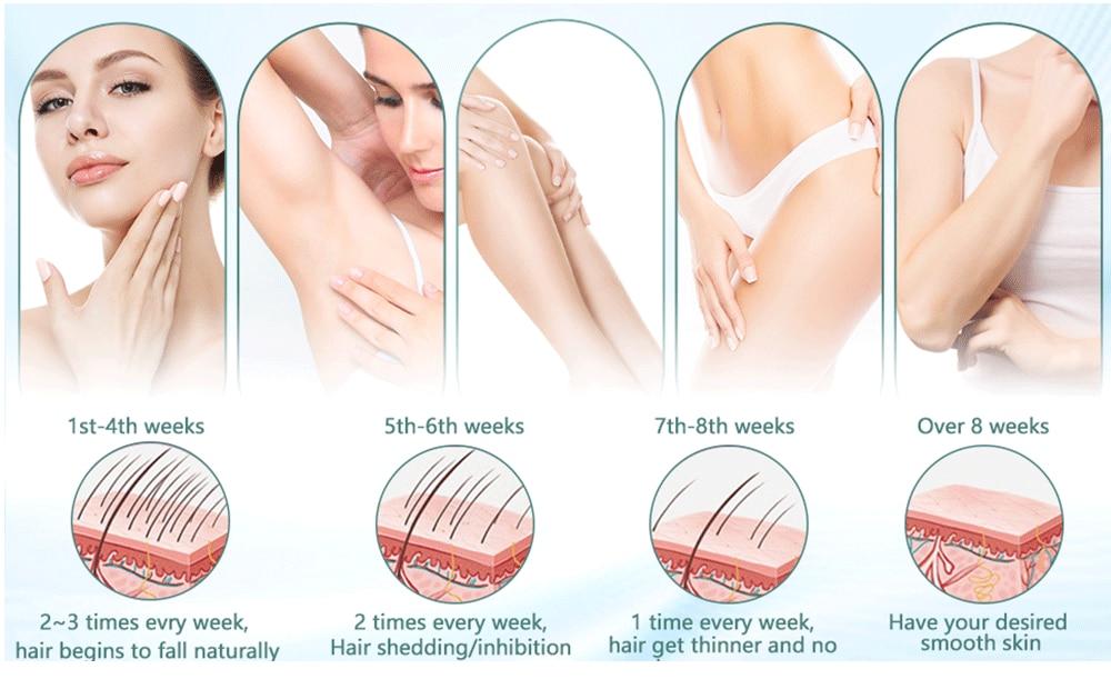 KODO 900000Flashes Laser Epilator Laser Hot Sell Permanent IPL Photoepilator Hair Removal Painless Electric Epilator Machine