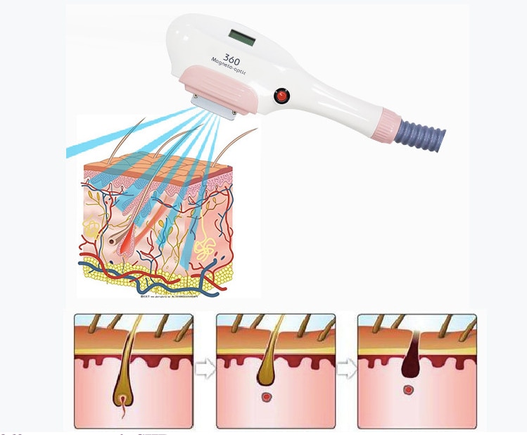 Multifunction 4 In 1 OPT IPL Laser Hair Removal Machine Skin Rejuvenation Nd Yag Laser Tattoo Removal SHR Epilator