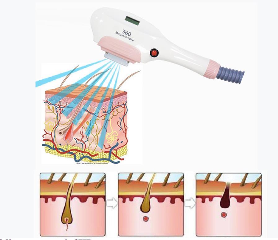 Multifunctional 360 Magneto Hair Removal Machine IPL OPT SHR Skin Renew Pigmentation Therapy Acne Treatment Skin Lift Device