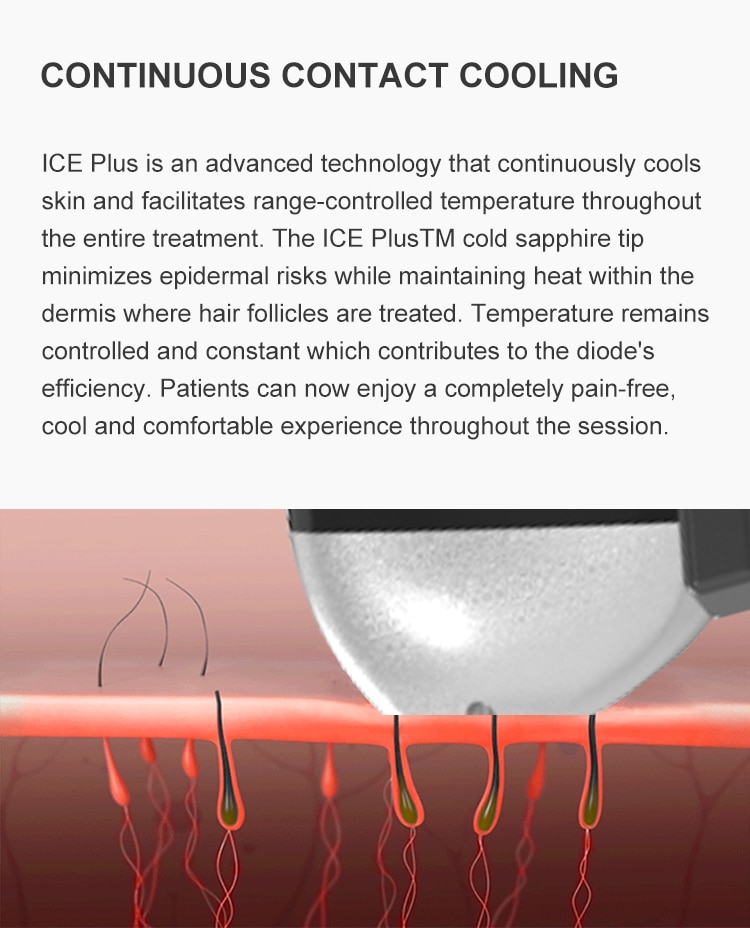 Ice Titanium Soprano Instrument Painless Permanent Epilator 755 808 1064nm Triple Wavelength Diode Laser Hair Removal Machine