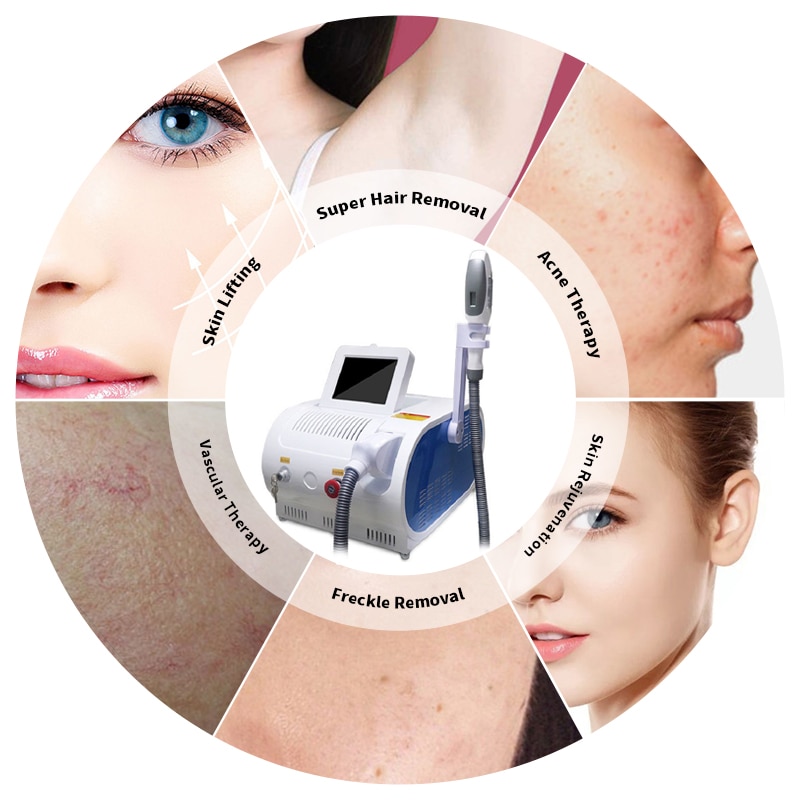 2 IN 1 IPL Laser Epilator Hair Removal Machine Laser IPL Nd Yag Tattoo Removal Whitening Skin Rejuvenation