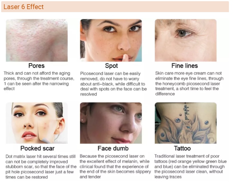 Laser Hair Removal Machine Professional IPL Portable Multifunction Nd Yag Laser With Laser Beam Beauty Machine