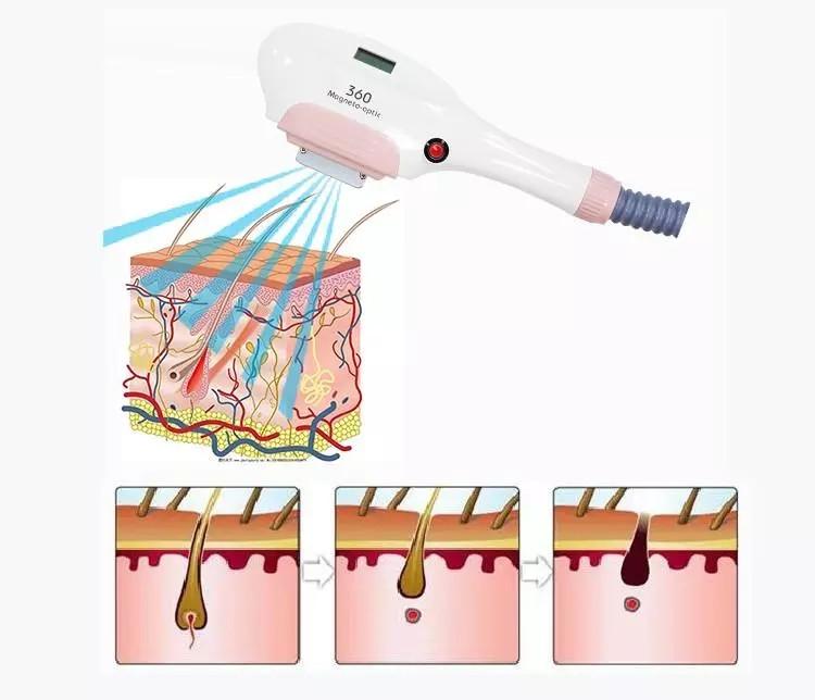 2022 IPL OPT SHR Hair Removal Laser Machine ND YAG Laser Tattoo Removal Carbon Stripping Machine Skin Rejuvenation For Salon