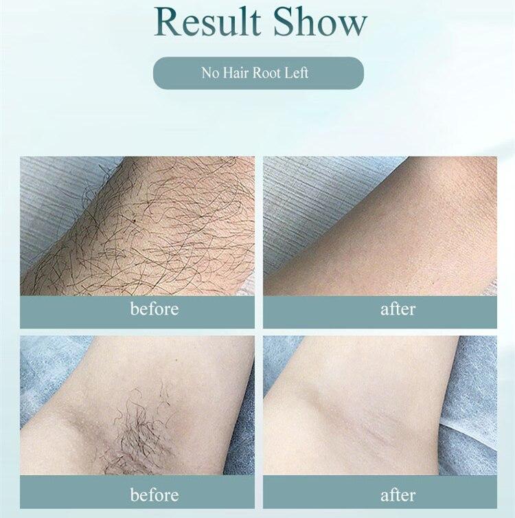900000 Flashes Laser Epilator electric Epilator Permanent IPL Photoepilator Hair Removal Painless laser hair removal machine