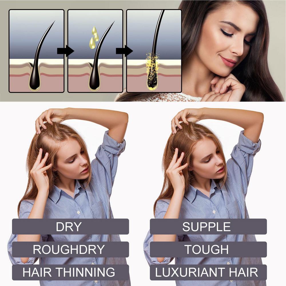 Hair Oils For Hair Growth Anti-Breakage Hair Growth Oil For Women Biotin And Collagen For Natural Hair Growth Anti Hair Loss