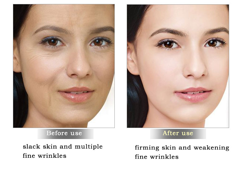 ARTISCARE Snail Repair Facial Cream + Peptide Eye Serum Anti Wrinkle Shrink Pores Face Care Fine Lines Remove Dark Circles 2Pcs