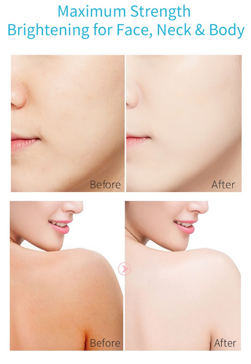 MELAO Pigmentation Dark Spot Corrector Remover Serum Skin Whitening Brightening for face 30ml