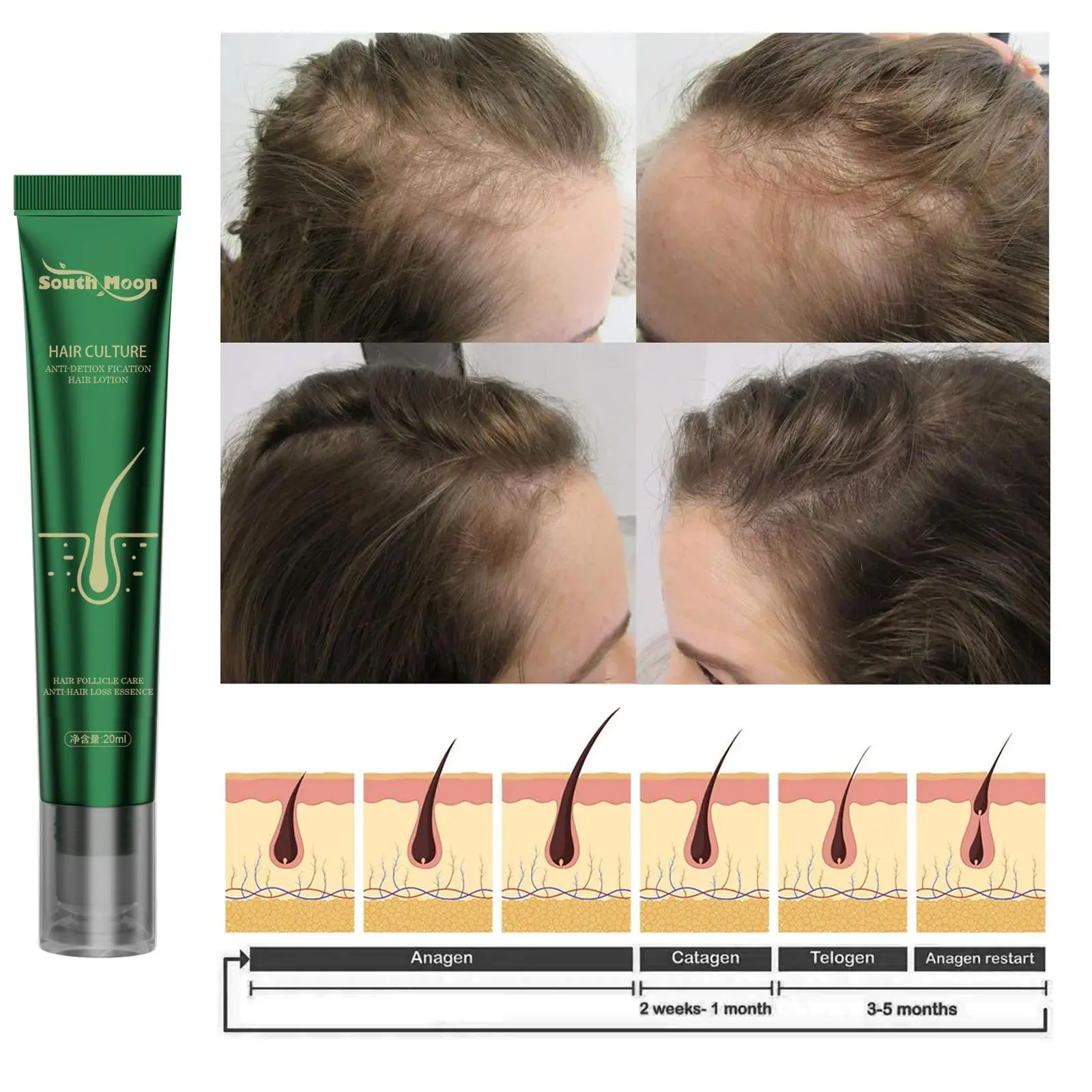 20/15/10X Biotin Fast Oil Hair Regrowth Serum Hair Thinning Treatment Liquid Anti-Hair Loss For Women