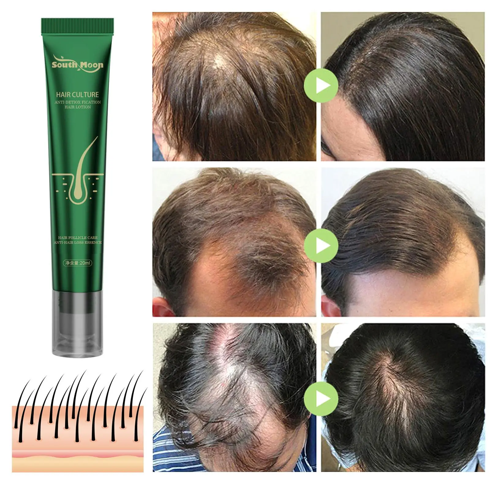 20/15/10X Biotin Fast Oil Hair Regrowth Serum Hair Thinning Treatment Liquid Anti-Hair Loss For Women