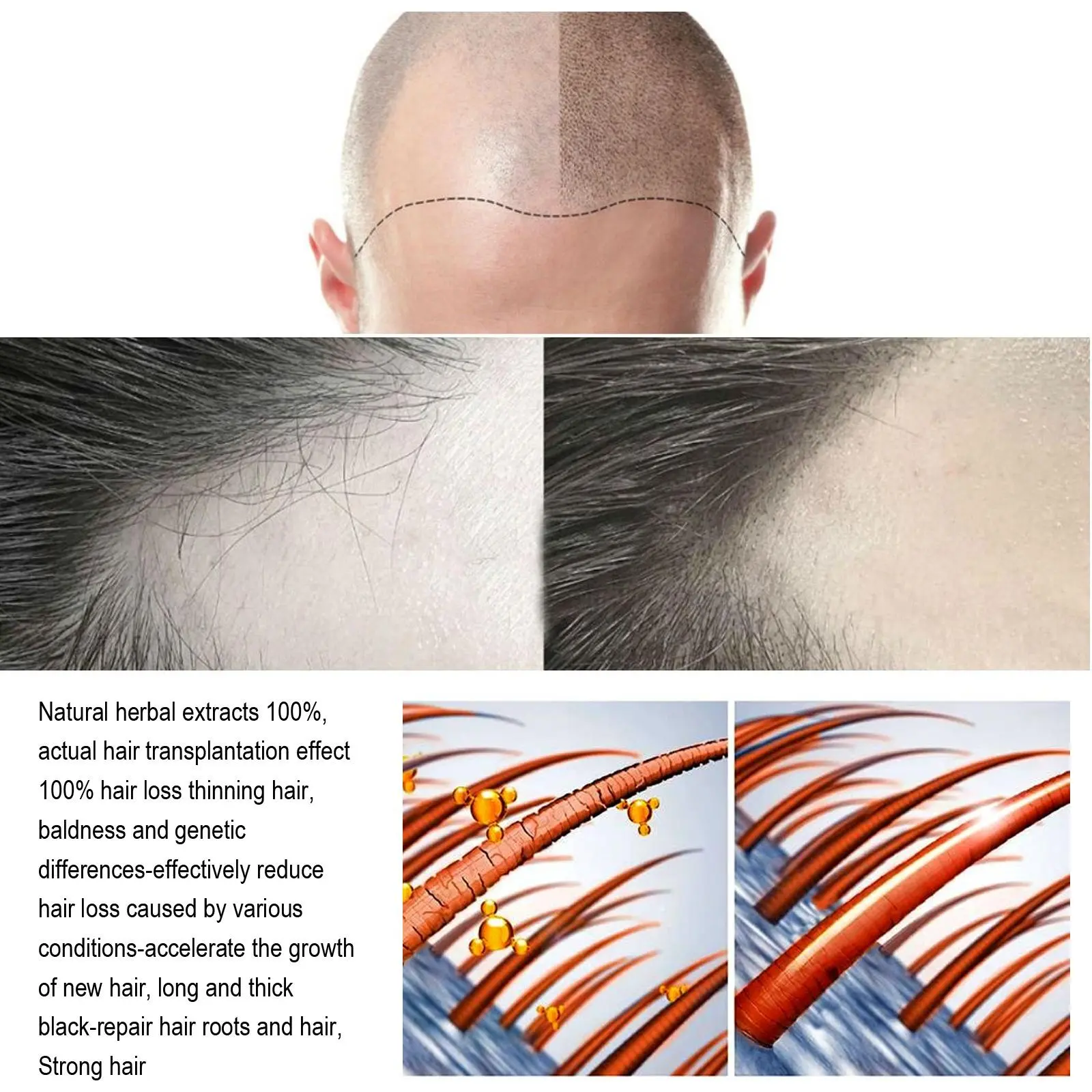 2023 Biotin Fast Oil Hair Regrowth Serum Hair Thinning Treatment Liquid Liquid Anti-Hair Loss For Women Amp Men