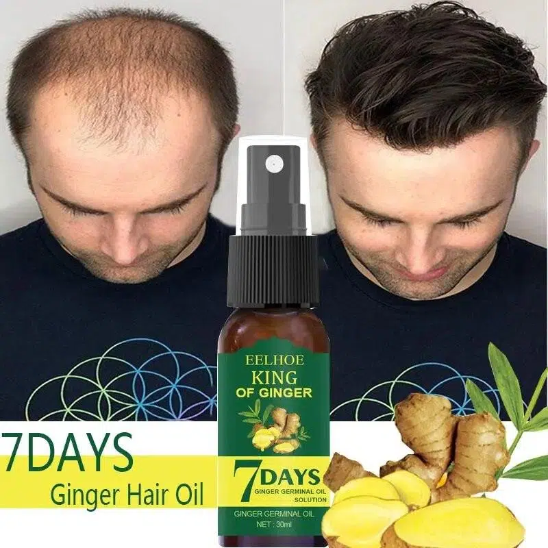 Regrow 7 Day Ginger Germinal Hair Growth Serum 3PCS/5PCS Prevent Hair Loss Scalp Treatment Thicker Hair Care