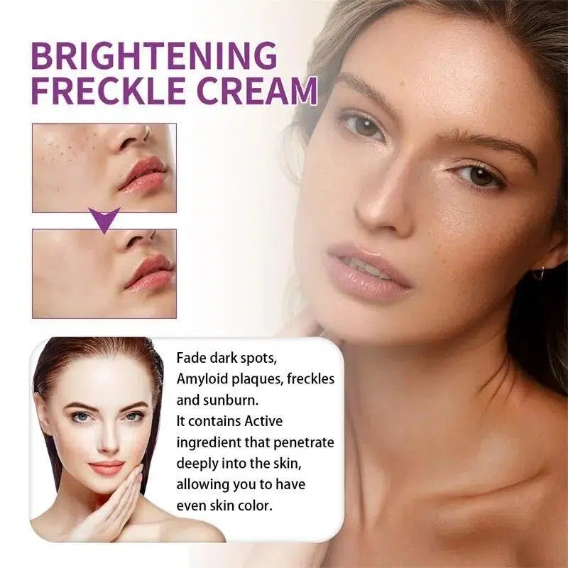 Nicotinamide Whitening Freckle Removing Cream Effectively Remove Melasma Dark Spot Acne Marks Lightening Melanin Face Skin Care