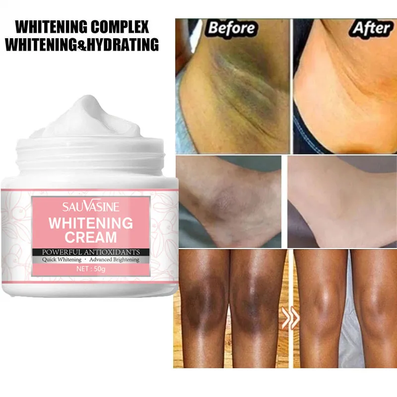 Lightening Whitening Bleaching Cream Remove Dark Spots Body Brightening Skin Body Whitening Cream Intimate Areas Underarm Knee Buttocks Private Bleach