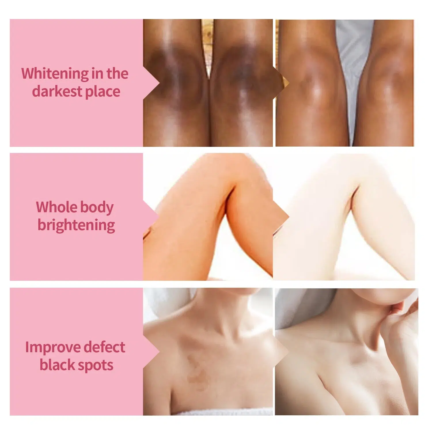 Body Whitening Cream Underarm Knee Buttocks Private Bleach Remove Melanin Pigmentation Improve Dull Nourish Brighten Skin Care