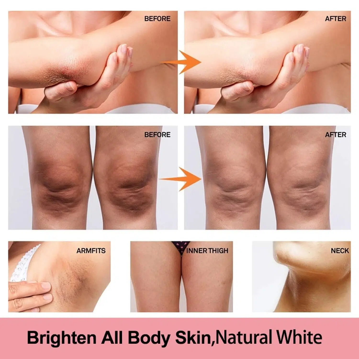 Lightening Whitening Bleaching Cream Remove Dark Spots Body Brightening Skin Body Whitening Cream Intimate Areas Underarm Knee Buttocks Private Bleach