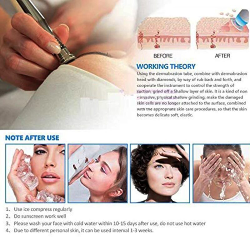 Replacement 3 Wands 9 Tips Dermabrasion Tips Stainless Steel Filter Set Beauty Tool - Image 5