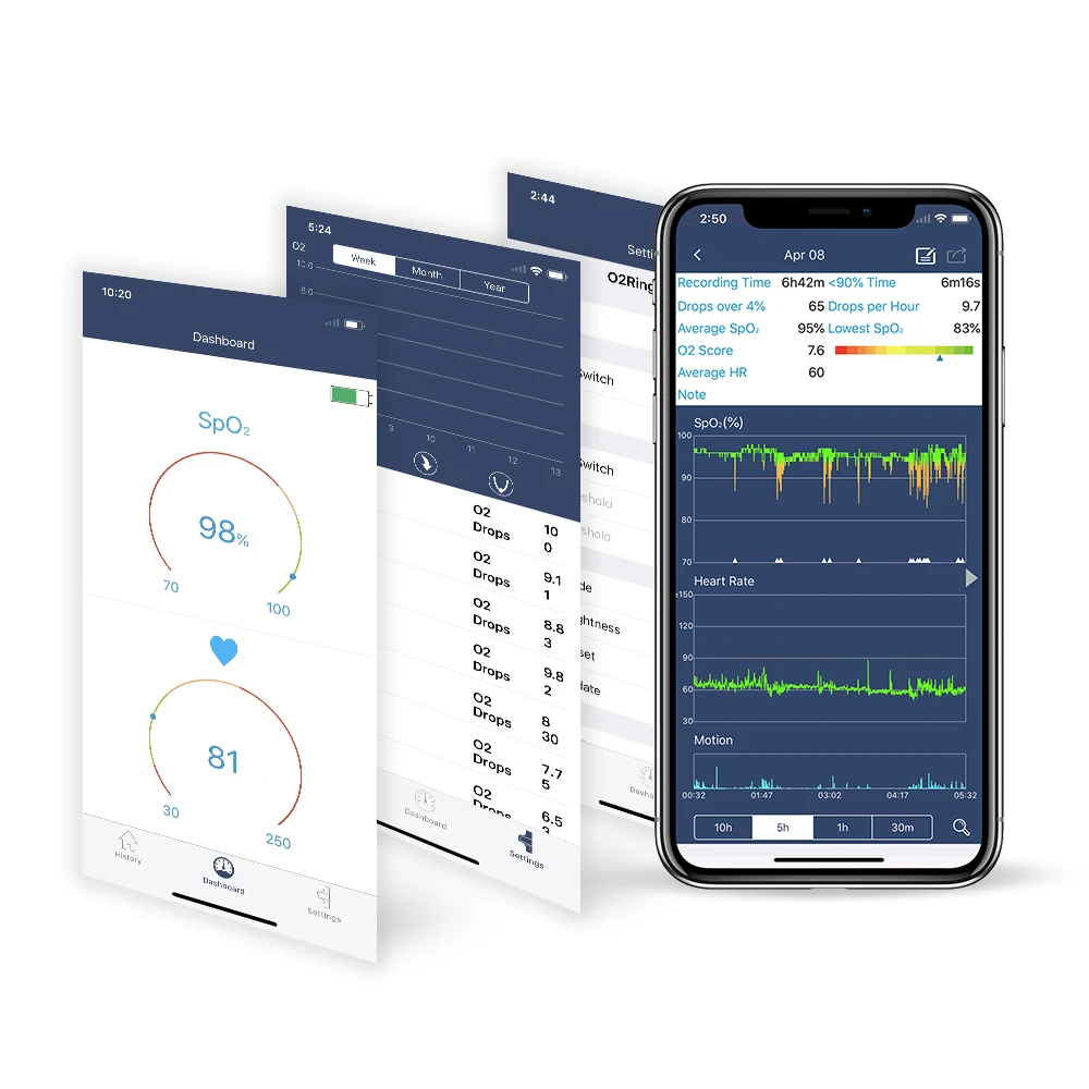 Viatom Checkme O2 Max Sleep Oximeter Oxygen Saturation Monitor for Sleep Apnea with Vibration Alarm APP PC Report Android ios